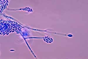 Fusarium solani. La forme en fuseau de ses spores lui donne son nom. Crédit : <em>Public Health Image Library</em>, Dr. Libero Ajello
