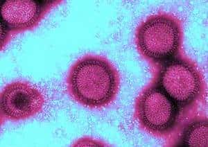 Quelques virus H1N1. © Licence <em>Commons</em>