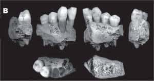 Les morceaux de mandibules attribués à un enfant néandertalien. Le doute subsiste. Dans le cas contraire, l'affaire serait celle d'un acte de cannibalisme... © Fernando V. Ramirez Rozzi <em>et al.</em>/ <em>Journal of Anthropological Sciences</em>