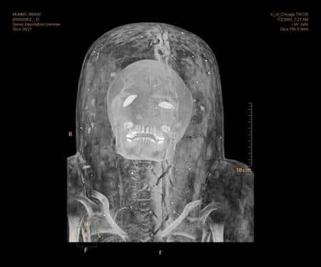 Même le scarcophage de la momie ne peut la dissimuler au regard perçant de ce nouveau genre de scanner qu'est le Brilliance iCT. Crédit : Anna Ressman/<em>Oriental Institute/University of Chicago</em>