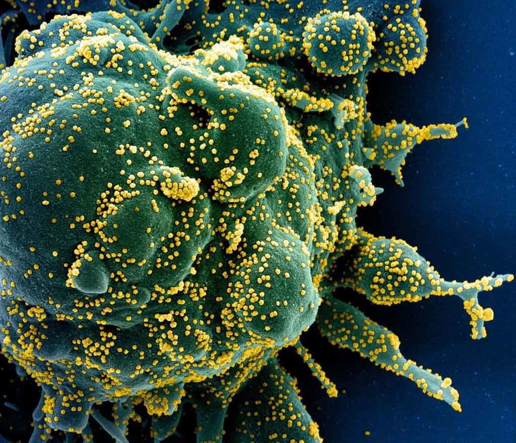 Micrographie électronique à balayage colorisée d'une cellule apoptotique (verte) fortement infectée par des particules du virus SARS-COV-2 (jaune), isolée d'un échantillon de patient. Image capturée au <em>National Institute of Allergy and Infectious Diseases</em> (NIAID), <em>Integrated Research Facility</em> (IRF) à Fort Detrick, Maryland. © NIH, NIAID