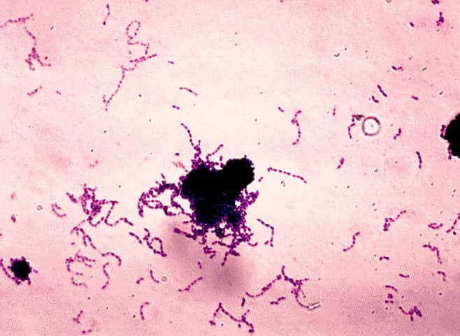 La bactérie <em>Streptococcus mutans</em> est l'une des principales responsables des caries dentaires, mais n'est pas la seule. L'alimentation, le stress et le système immunitaire sont autant de paramètres qui interviennent également. © CDC, Wikipédia, DP