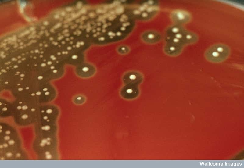 Des colonies de <em>Streptoccocus pyogenes</em>, la bactérie responsable de l'angine. Elle peut aussi être causée par différents virus. © <em>Royal Veterinary College</em>, Wellcome Images, cc by nc nd 2.0