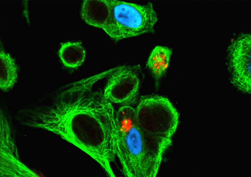 Infection par le cytomégalovirus (CMV), ici chez l’humain. En rouge et vert, les cellules <em>Natural Killer</em> essayent de se frayer un chemin vers la cellule infectée. © Inserm, Jabrane-Ferrat, Nabila