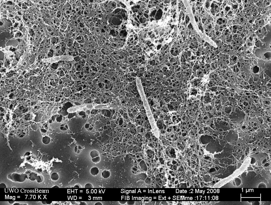 Sous le regard d'un microscope électronique, <em>Desulforudis audaxviator</em> se présente sous forme de bâtonnets de quelques microns de longueur. © DP