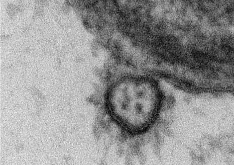 Cette photo représente le coronavirus SARS-CoV-2 responsable de la maladie COVID-19 observé en gros plan à la surface d’une cellule épithéliale respiratoire humaine. Sa double membrane et sa couronne de glycoprotéines sont bien visibles. © M.Rosa-Calatrava, O.Terrier, A.Pizzorno, E.Errazuriz-Cerda