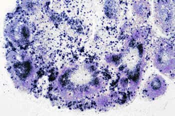 Ganglion mésentérique infecté par la souche SIVmac251, variante animale du VIH. Les taches noires représentent les cellules qui répliquent le virus. Crédit : INSERM 2007.
