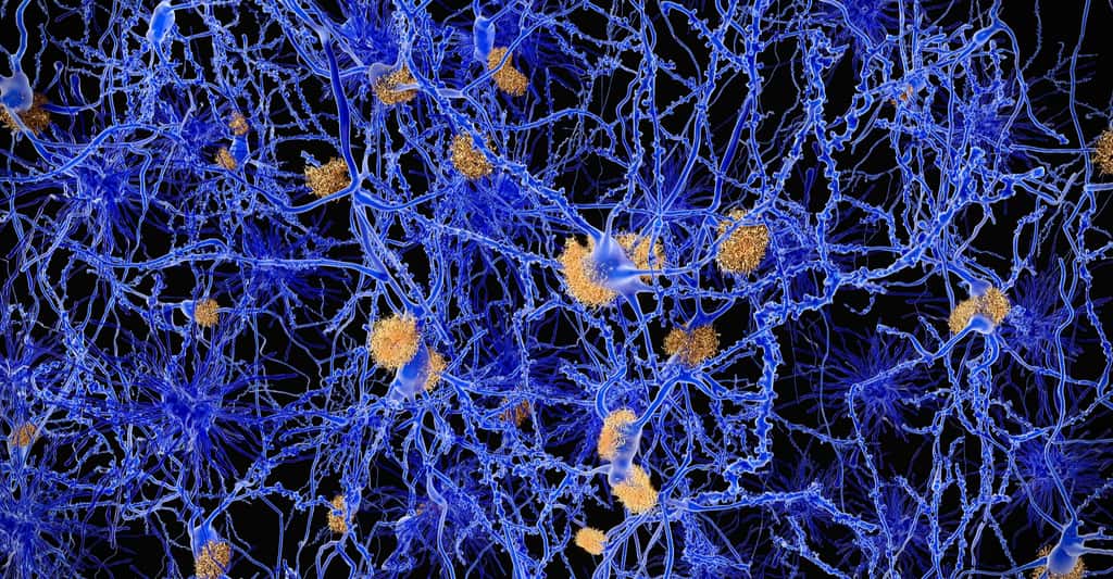 Chez les malades, des plaques bêta-amyloïdes gênent le fonctionnement normal du cerveau. © Juan Gaertner, Shuttestock