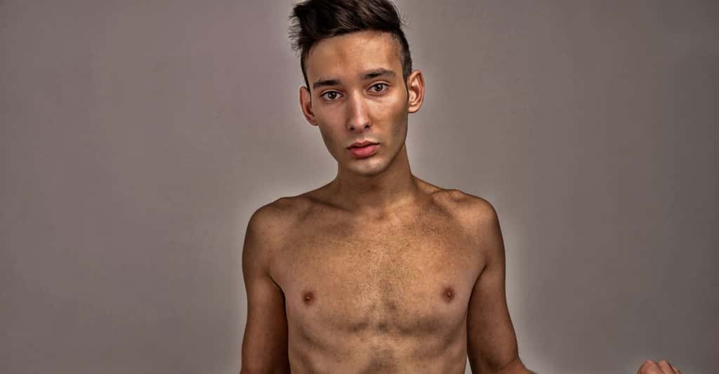 Les garçons aussi peuvent souffrir d’anorexie. Elle se traduit souvent par une hyperactivité. © Iulian Valentin, Shutterstock