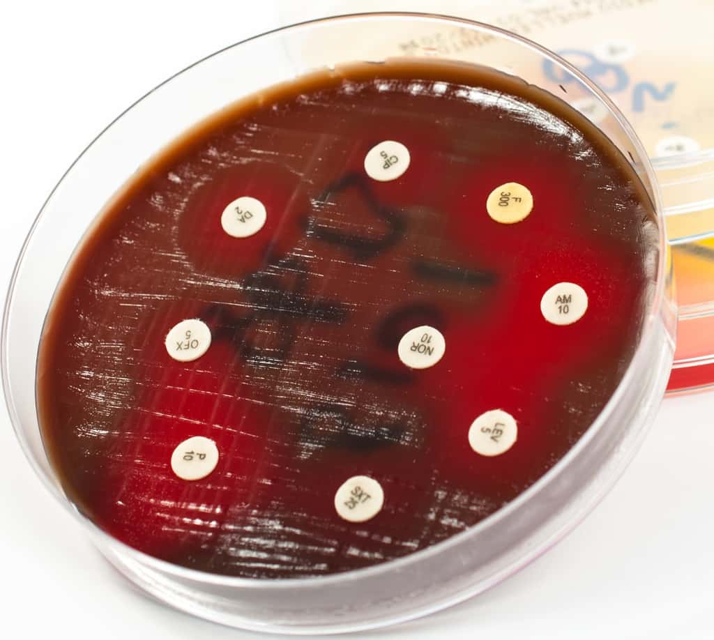 Un antibiogramme montrant la sensibilité d'une bactérie aux antibiotiques : contribution de la bactériologie dans le cas d'une infection ostéo-articulaire. © raresb, Adobe Stock 