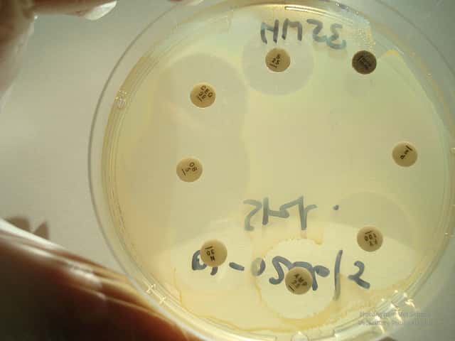 L'antibiogramme sert à tester la sensibilité des bactéries aux antibiotiques. © School of Veterinary Medicine and Science University of Nottingham, UK, Flickr, CC by-nc-sa 2.0