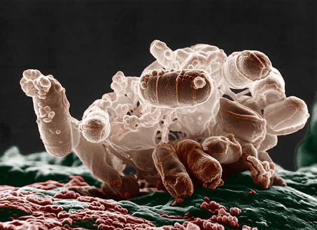 Des milliards de bactéries comme celles-ci ont élu domicile dans nos intestins. Le système immunitaire ne doit pas se tromper et attaquer seulement les envahisseurs. Cet équilibre immunitaire compliqué fait intervenir de nombreux acteurs, dont le mucus fait partie. © Microbe World, Flickr, cc by nc sa 2.0