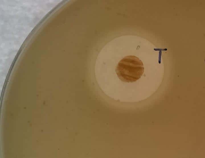 La bactérie <em>S. myrophorea</em> (dans le rond marron) fait ici montre de son efficacité en créant une zone d'inhibition tout autour d'elle (en beige) pour stopper le SARM, ou staphylocoque doré résistant à la méticilline, étalé dans le reste de la boîte de Pétri. © Gerry Quinn, <em>Swansea University</em>