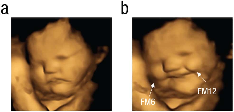 Content ! Exemple de visage de rire d'un fœtus exposé à la carotte : (a) visage neutre, (b) visage avec rire. © Beyza Ustun, Université de Durham, Département de psychologie, Psychological Science, CC by-nc 4.0