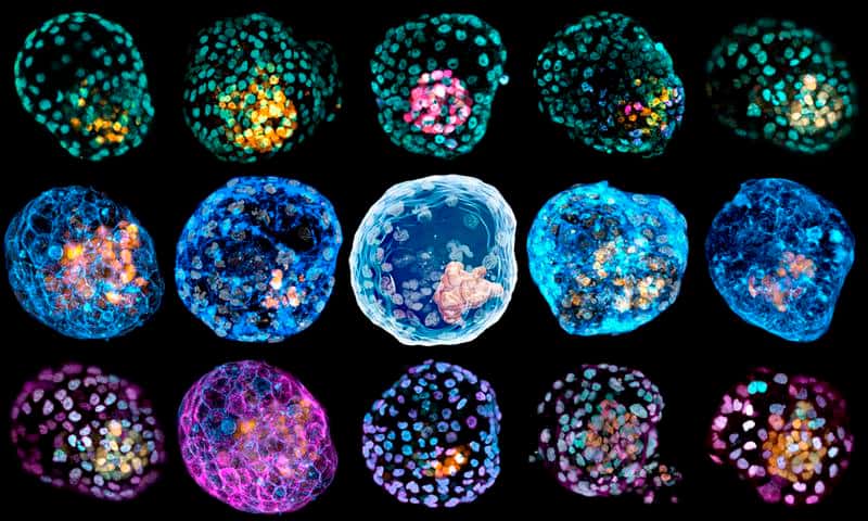 Les différents blastoïdes obtenus par l'équipe de la <em>Monash University</em>. Chaque couleur représente une population cellulaire distincte. © <em>Monash University</em>