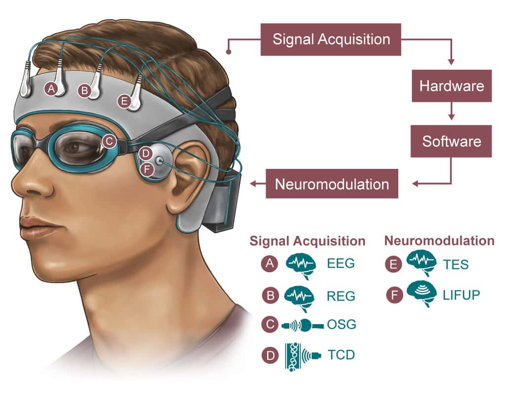 Une représentation de ce à quoi devrait ressembler le bonnet, avec ses quatre capteurs et deux stimulateurs. © <em>NeuroEngineering Initiative, Rice University</em>