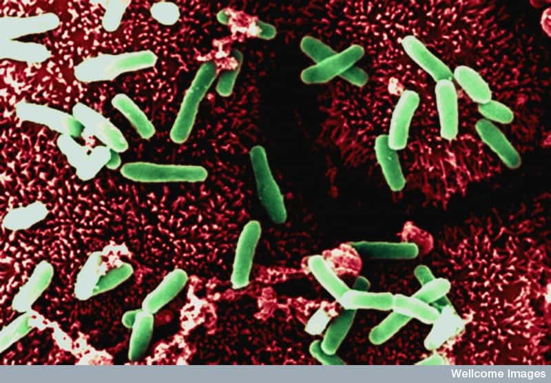 Les bactéries intestinales, comme <em>Clostridium difficile</em>, contribuent au bon fonctionnement du système immunitaire. Mais certaines sont pathogènes et le mésusage des antibiotiques renforce leur résistance aux traitements. © <em>Med. Mic. Sciences Cardiff</em>, Wellcome Images, cc by nc nd 4.0