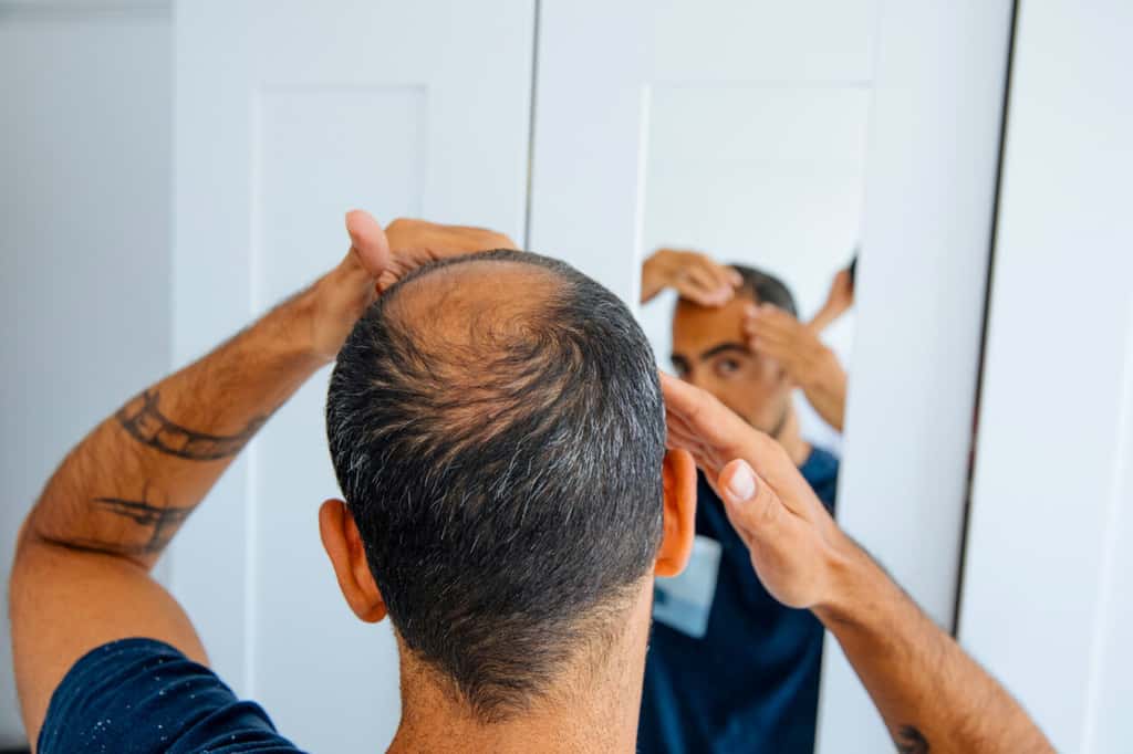  Le mécanisme exact par lequel le gel de désoxyribose stimule la croissance capillaire reste à élucider. © Agrobacter, iStock