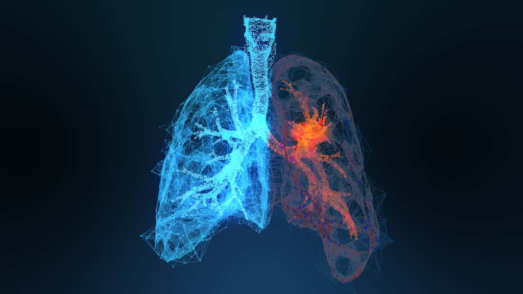 La pollution atmosphérique est liée à l'apparition du cancer du poumon. © appledesign, Adobe Stock