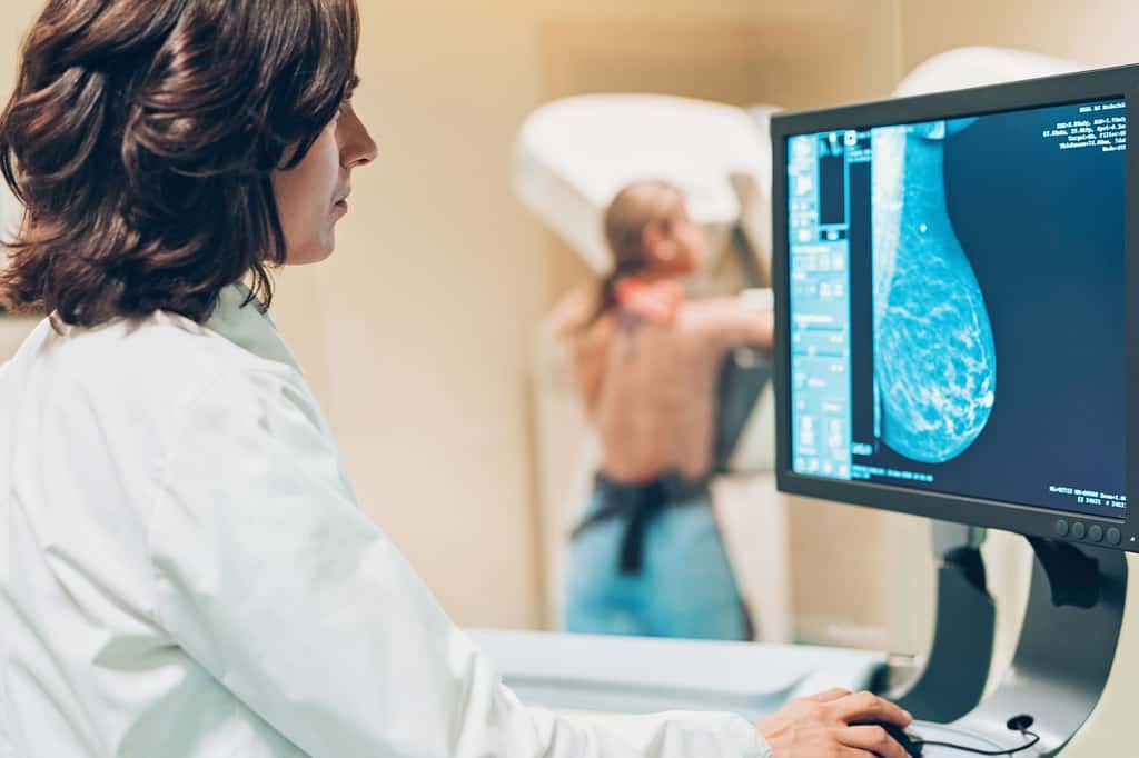 Le cancer du sein peut mettre des années à se révéler. C'est une maladie qui évolue lentement, ce qui explique pourquoi il faut répéter tous les deux ans les mammographies. © Pixelfit, Getty Images
