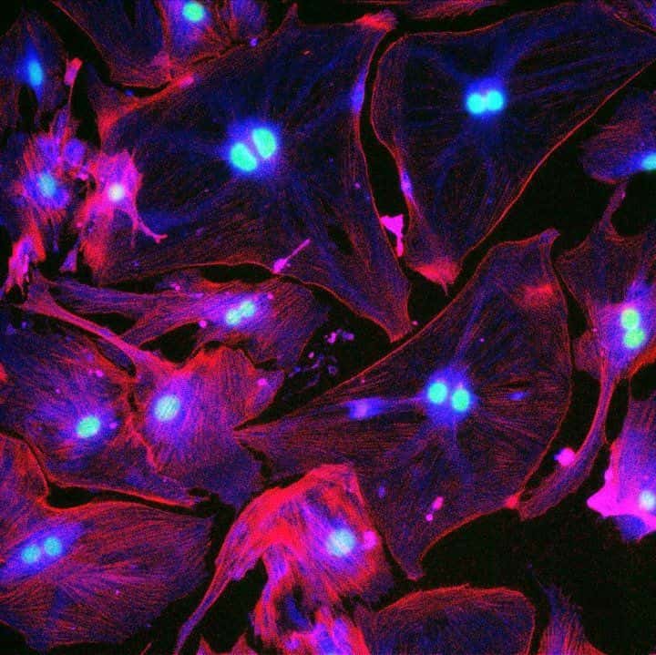 Visualisation des noyaux doubles ou triples caractéristiques des cellules « zombies », grâce à une étiquette fluorescente améliorée dans le cadre de la nouvelle étude. © Nabora Reyes, Peng Lab