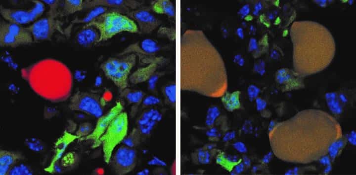 La thérapie de transdifférenciation testée chez la souris. À gauche : cellules cancéreuses exprimant la GFP (<em>green fluorescent protein</em>) en vert et adipocytes normaux en rouge, au niveau d’une tumeur. À droite : les cellules cancéreuses exprimant la GFP sont devenues des adipocytes qui apparaissent marron (vert + rouge). © Département de Biomédecine, Université de Bâle, 