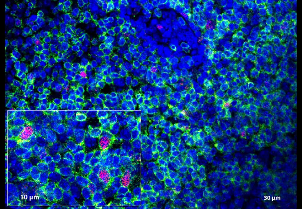 Visualisation de la prolifération des cellules immunitaires (lymphocytes) dans les ganglions mésentériques sous l’influence du microbiote modulé par le régime gras. © Soraya Taleb/PARCC