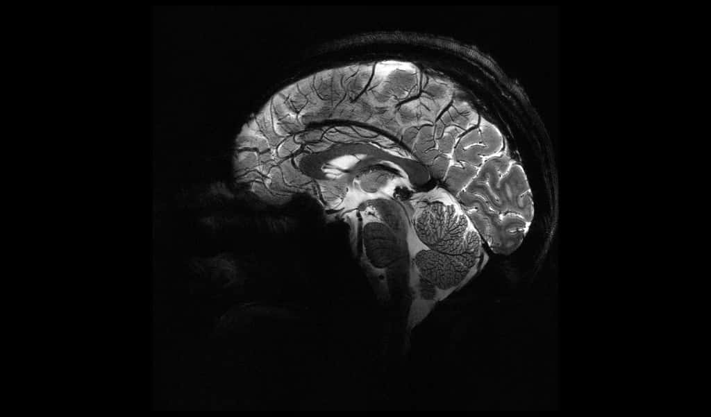 Coupe sagittale du cerveau (traversant le cerveau d’avant en arrière). Cette coupe permet de voir de façon très fine et détaillée le cervelet avec ses nombreuses ramifications. Le cervelet est impliqué dans le contrôle de la fonction motrice et pourrait avoir un rôle dans le contrôle cognitif et émotionnel. Des anomalies de structure pourraient être associées à des troubles psychiatriques telles que la schizophrénie, les troubles bipolaires… Son étude avec l’IRM à 11,7 teslas devrait permettre d’apporter un regard nouveau sur cette région et son rôle dans ces maladies. © CEA