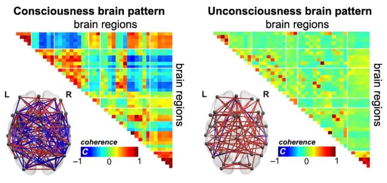Les communications entre les régions du cerveau diffèrent entre un cerveau conscient ou inconscient. © E. Tagliazucchi & A. Demertzi