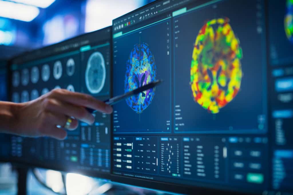La maladie d'Alzheimer détectée chez un jeune adulte : un cas extrême stupéfiant. © Gorodenkoff, iStock