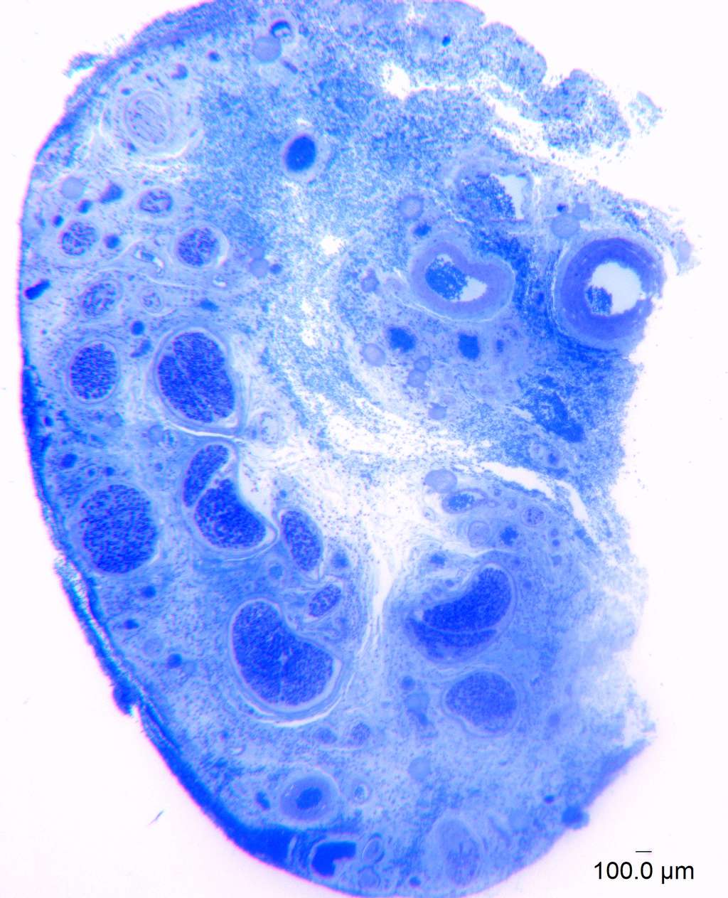 Coupe transversale agrandie du nerf dorsal du clitoris humain, principalement responsable de la sensation clitoridienne. Chaque point minuscule, bleu foncé, placé à l'intérieur des grands cercles bleus, représente une fibre nerveuse individuelle du nerf dorsal. Les chercheurs ont agrandi les échantillons au microscope 1 000 fois et utilisé un logiciel d'analyse d'images pour compter les fibres nerveuses. © <em>Oregon Health & Science University</em>
