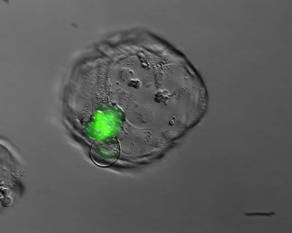 Cette cellule est un hybride : l’ovocyte contient un noyau (en vert) récupéré depuis une cellule somatique d’une patiente touchée par le diabète de type 1. © Dieter Egli, NYSCF