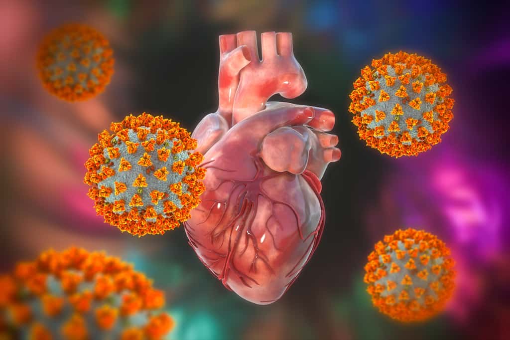 La myocardite peut être causée par un virus comme celui de la variole ou de la Covid-19. © Kateryna_Kon, Adobe stock