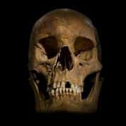 Le crâne de Richard III, dont le squelette a été découvert en 2012 à Leicester. © University of Leicester