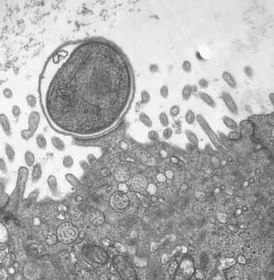 Le parasite microscopique <em>Cryptosporidium parvum</em> accroché à la muqueuse intestinale (x 11.000). © Alton B. Farris et <em>al.</em>