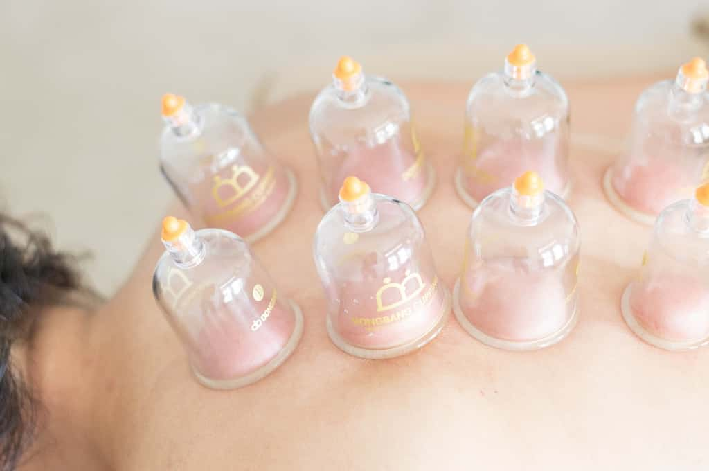 Le cupping consiste à créer un effet de succion pour attirer le sang à la surface et « purifier » le corps. © 7thedenspa, Pixabay 