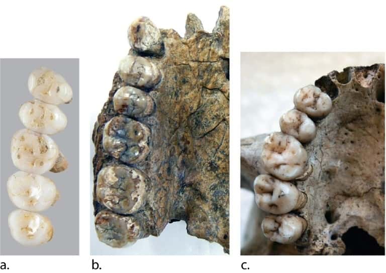 Comparaison entre des dentitions, sur l'île de Luçon le 15 mars 2019. © Florent DETROIT - Florent DETROIT/AFP/Archives