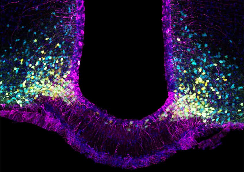 Le marquage violet montre les « tanycytes », qui forment la porte cellulaire du cerveau à la leptine, tandis que, en jaune, on observe les neurones stimulant l’appétit et en bleu les neurones supprimant l’appétit. Ces deux types de neurones sont les cibles de la leptine ; les premiers vont être inhibés et les deuxièmes activés par le signal « coupe-faim » de cette hormone. © Vincent Prévot
