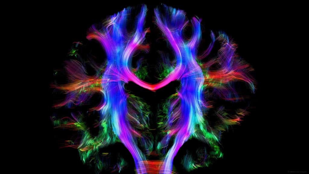 Des connexions dans le cerveau