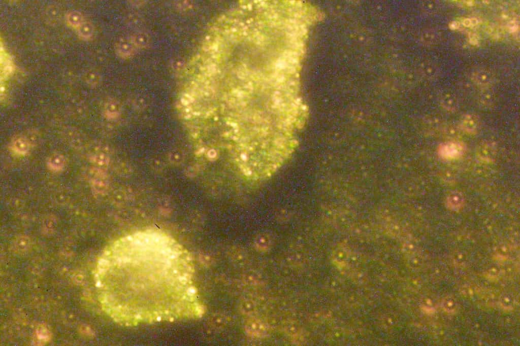 Nanomédecine : des nanoparticules s'attaquent à des cellules cancéreuses