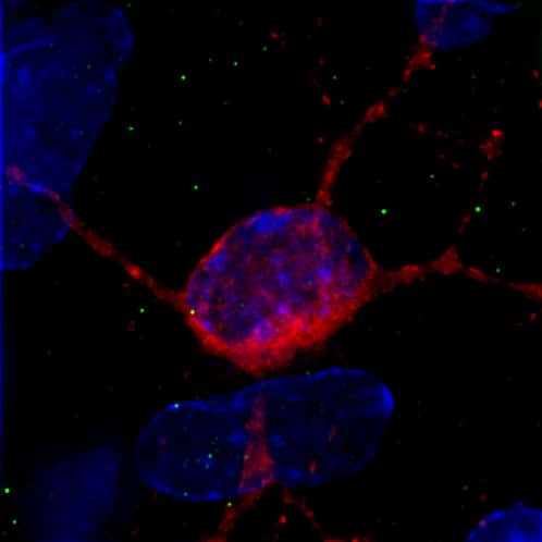 Neurone exprimant la protéine hungtingtine