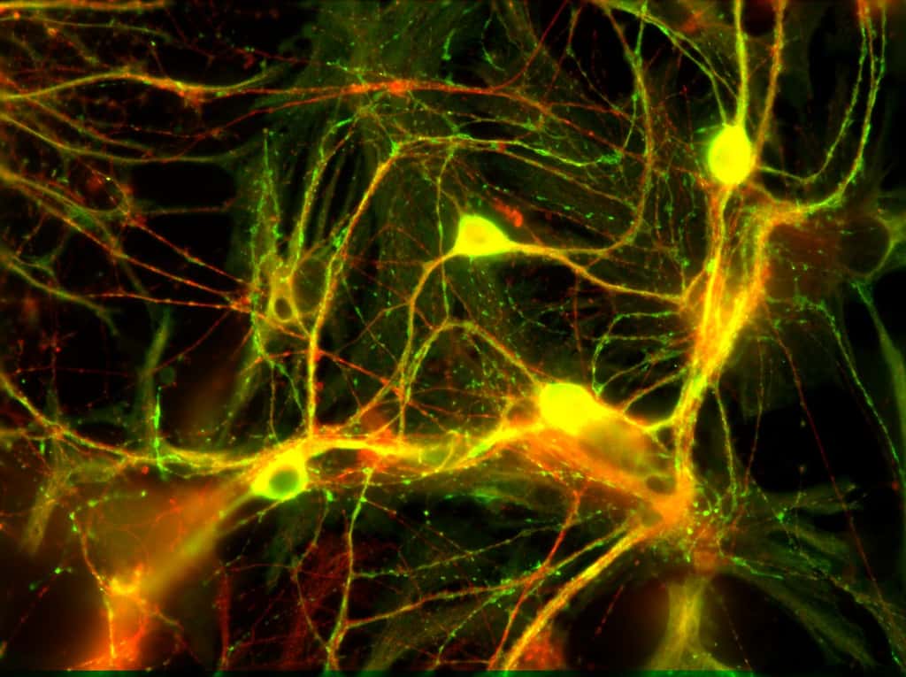 Neurones de l'hippocampe et leurs neurotransmetteurs