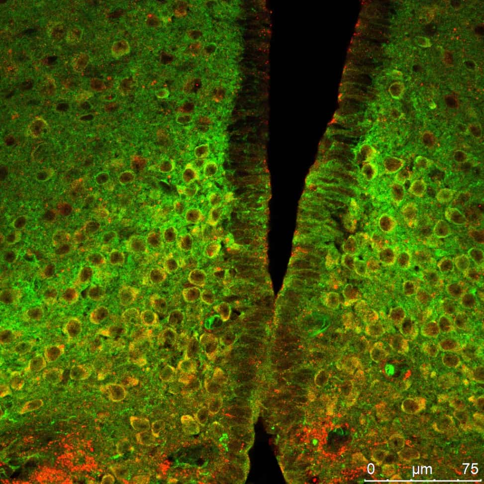 Neurones de l'hypothalamus, au cœur du cerveau
