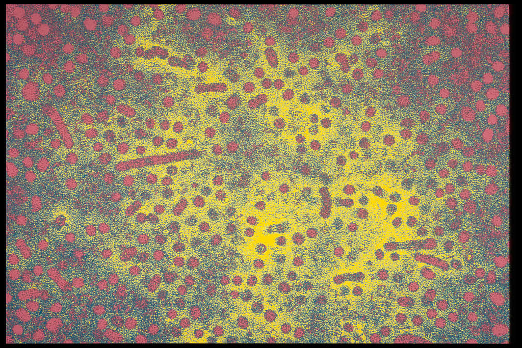 Des virus de l'hépatite B. © Sanofi Pasteur