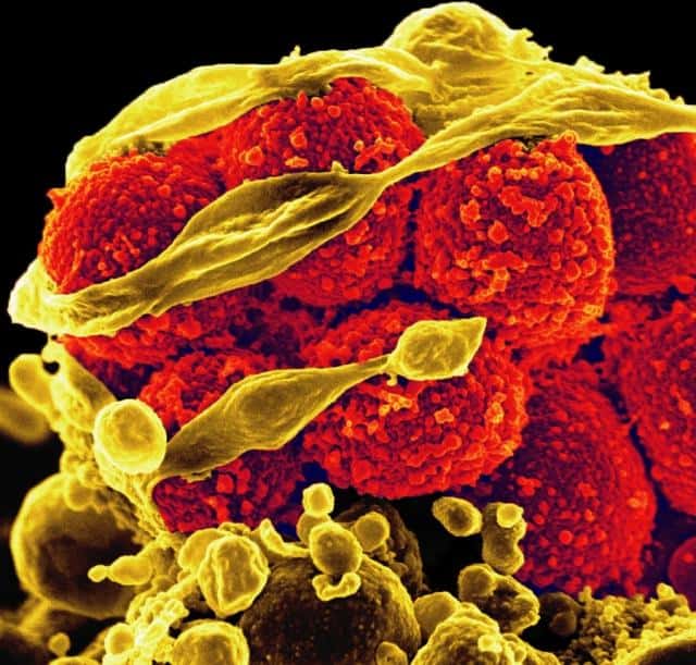 Image d’un Staphylococcus aureus résistant à la méticilline (Sarm), un germe qui pose de nombreux problèmes dans les hôpitaux. La recherche de nouveaux antibiotiques est un enjeu majeur de la microbiologie. La solution viendra-t-elle des Crispr ? © NIAID, Flickr, cc by 2.0