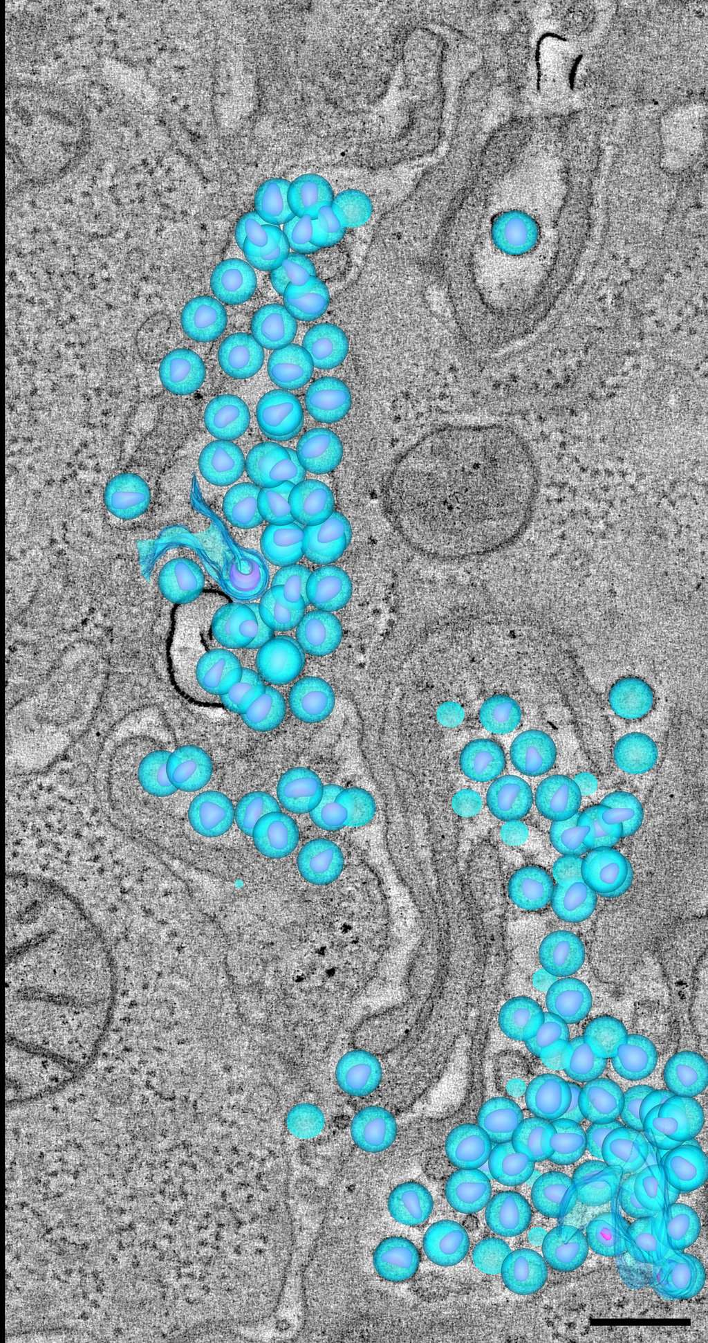 Image de tomographie électronique montrant un amas de particules virales (en bleu) localisé dans l’espace entre deux cellules. © Institut de technologie de Californie.