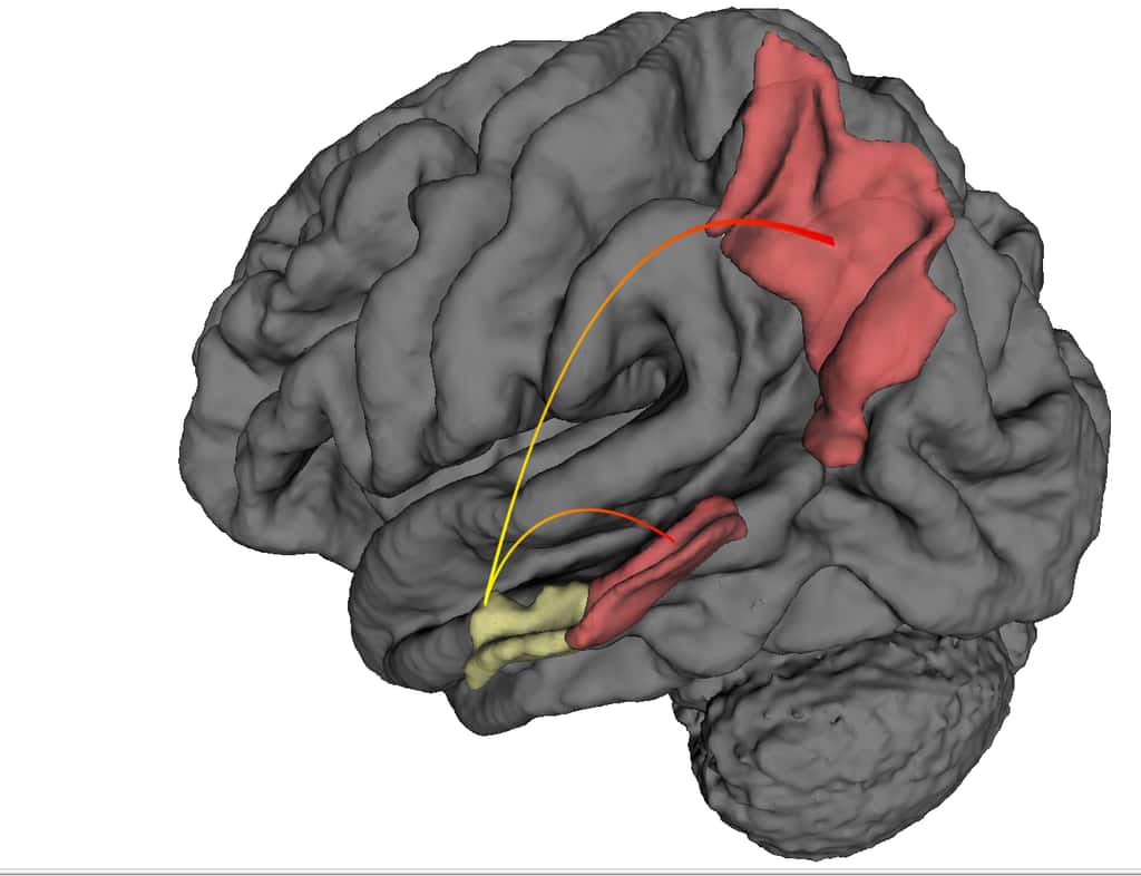 En utilisant une technique d’imagerie par résonance magnétique fonctionnelle à haute résolution, des chercheurs ont montré que la maladie d'Alzheimer prennait naissance dans le cortex entohrinal (jaune) et progressait vers d’autres régions cérébrales (rouge) comme le cortex perirhinal et le cortex pariétal posterieur. © Scott Small, centre medical de l’univesité Columbia.