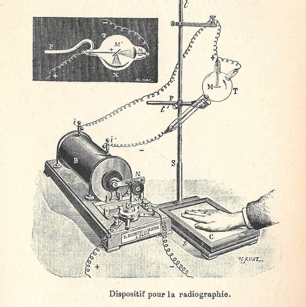Un dispositif pour la radiographie au début du XX<sup>e</sup> siècle (cliché datant d'environ 1900). © René Hourdry, <em>Wikimedia Commons</em>, CC BY-SA 4.0