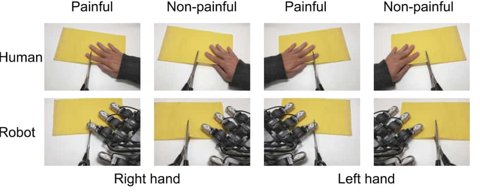 Les volontaires ont regardé différentes photographies montrant une main d’humain ou de robot, dans une situation douloureuse ou pas. © Suzuki <em>et al.</em>, Nature/em&gt; 2015&lt;, CC by 4.0