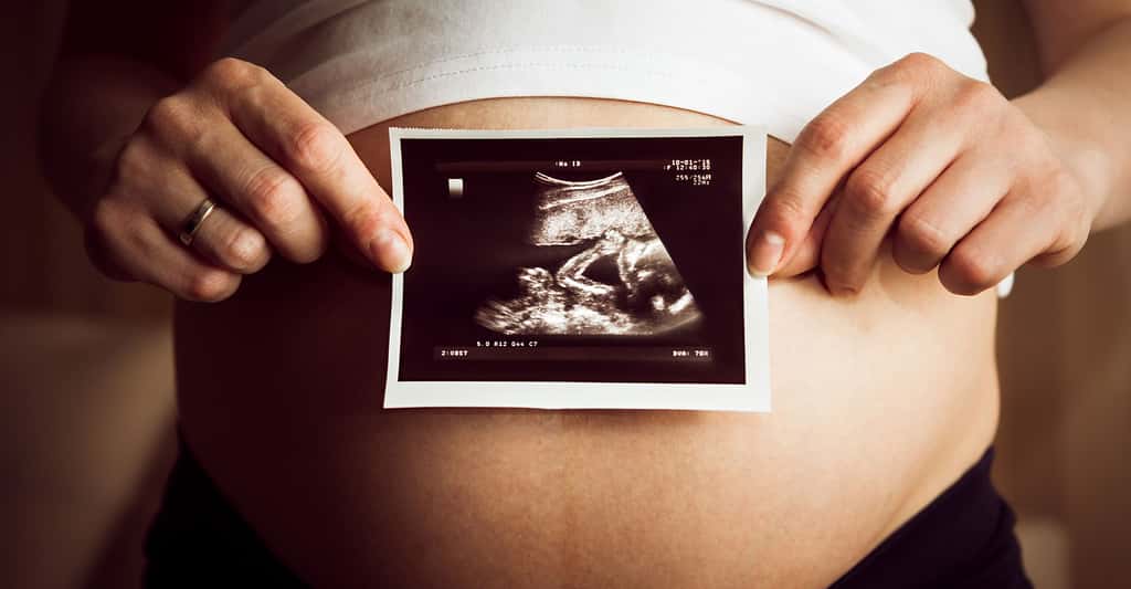 Échographie 3D d'un fœtus. Au neuvième mois de grossesse, le bébé est prêt pour l'accouchement. ©AndreyUG, Shutterstock